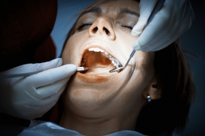 How Long Can You Leave a Cavity Untreated?